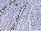 Anti-Human UMOD Antibody - ABMIUM