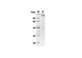 SDS-PAGE analysis of Human ADGRE5 proteins, 2 μg/lane of Recombinant Human ADGRE5 proteins was resolved with SDS-PAGE under reducing conditions, showing bands at 80.9 kDa.