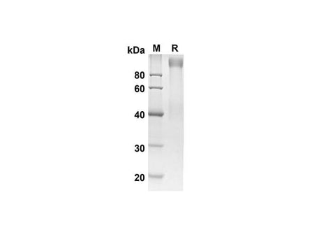 SDS-PAGE analysis of Human ADGRE5 proteins, 2 μg/lane of Recombinant Human ADGRE5 proteins was resolved with SDS-PAGE under reducing conditions, showing bands at 80.9 kDa.