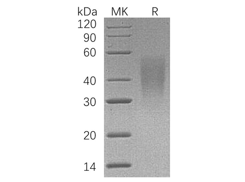 Recombinant Human LFA-3/CD58 Protein (His Tag) - ABMIUM