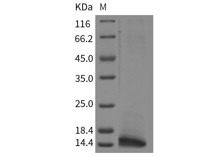 Recombinant Rat CLPS/Colipase Protein (His Tag) - ABMIUM
