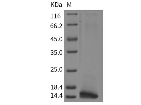 Recombinant Rat CLPS/Colipase Protein (His Tag) - ABMIUM
