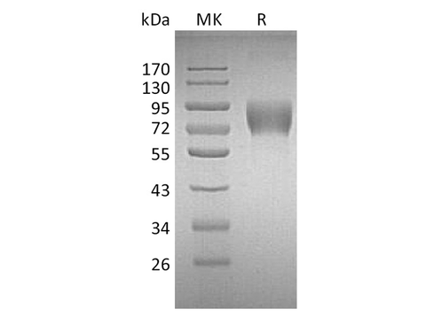 Recombinant Human CD226/DNAM-1 Protein (Fc Tag) - ABMIUM