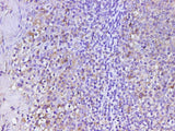 Anti-Human CD74 Antibody - ABMIUM