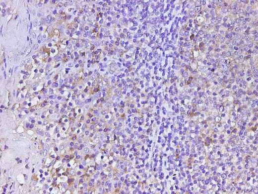 Anti-Human CD74 Antibody