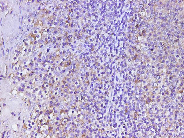 Anti-Human CD74 Antibody - ABMIUM