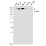 Western blot detection of KDM4A in Hela,A549,HL-60,U2OS,U87-MG cell lysates using KDM4A Rabbit mAb(1:1000 diluted).Observed band size:150kDa.