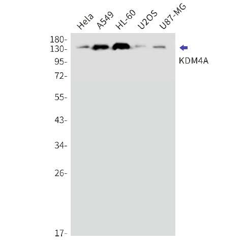 Western blot detection of KDM4A in Hela,A549,HL-60,U2OS,U87-MG cell lysates using KDM4A Rabbit mAb(1:1000 diluted).Observed band size:150kDa.