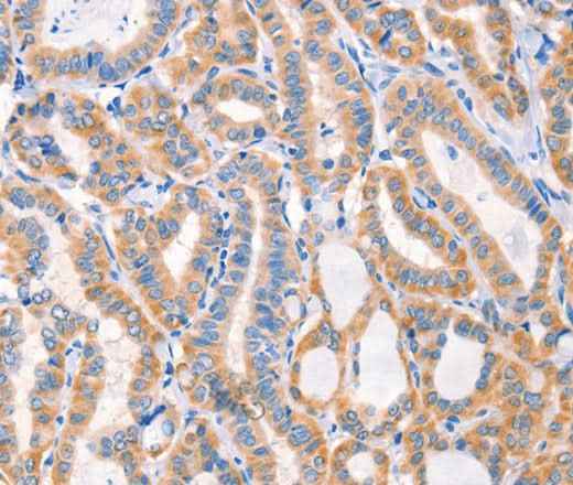 Anti-Human/Mouse/Rat Factor XIIIa Antibody