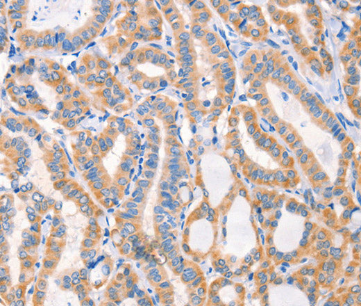 Anti-Human/Mouse/Rat Factor XIIIa Antibody - ABMIUM
