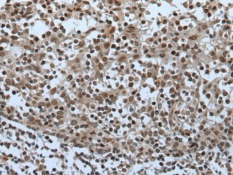 Immunohistochemistry of paraffin-embedded Human tonsil tissue using CELF5 Polyclonal Antibody at dilution of 1:65(×200)