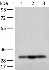 Western blot analysis of HepG2 Jurkat and 231 cell lysates using MRPS18B Polyclonal Antibody at dilution of 1:200