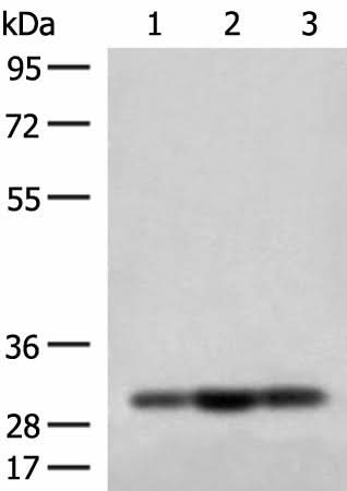 Western blot analysis of HepG2 Jurkat and 231 cell lysates using MRPS18B Polyclonal Antibody at dilution of 1:200