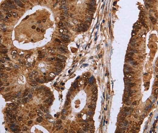 Anti-Human/Mouse EXTL3 Antibody