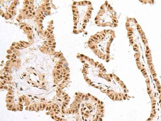 Anti-Human/Mouse KDM2A Antibody
