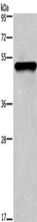 Anti-Human/Mouse/Rat KRT14 Antibody - ABMIUM
