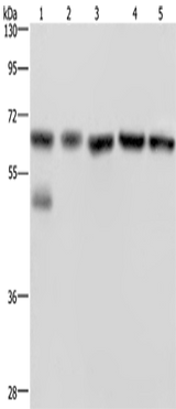 Anti-Human/Mouse/Rat NUP62 Antibody - ABMIUM