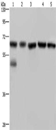 Anti-Human/Mouse/Rat NUP62 Antibody - ABMIUM
