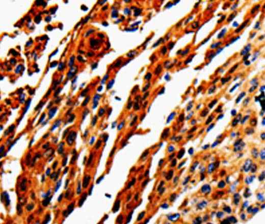 Anti-Human/Mouse/Rat ADD1 Antibody