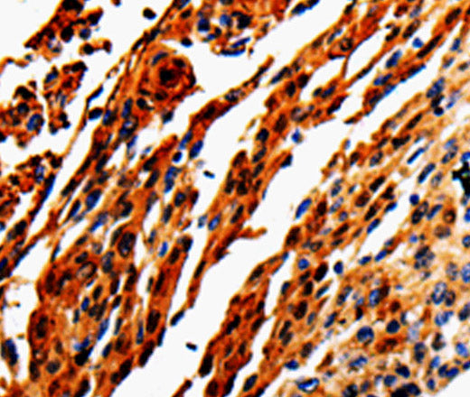 Anti-Human/Mouse/Rat ADD1 Antibody - ABMIUM