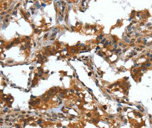 Anti-Human DEFA4 Antibody