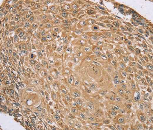 Anti-Human RNF148 Antibody