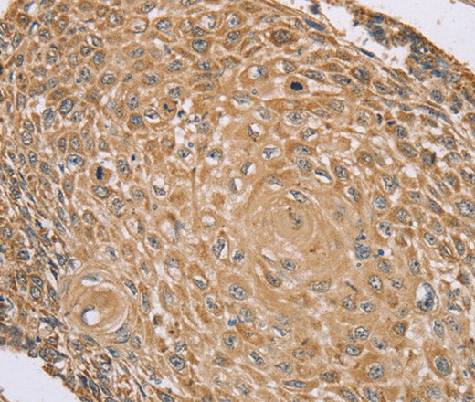 Anti-Human RNF148 Antibody - ABMIUM