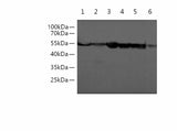 Western blotting with anti-Beta Tubulin monoclonal antibody at dilution of 1:5000. Lane 1: Hela cell lysates, Lane 2: Caco-2 cell lysates, Lane 3: HT-29 cell lysates, Lane 4: NIH/3T3 cell lysates, Lane 5:Raw264.7 cell lysates, Lane 6: Rat liver