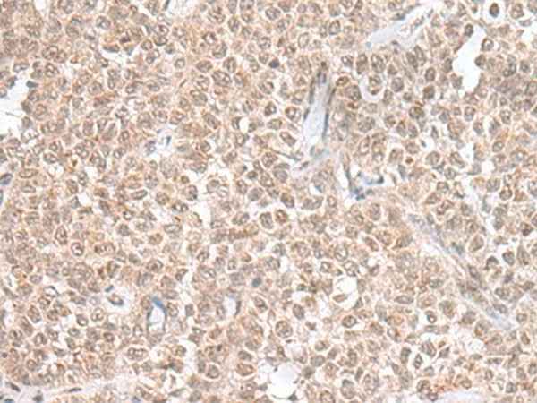 Anti-Human/Mouse THAP12 Antibody