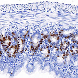 Immunohistochemistry analysis of paraffin-embedded mouse jejunum(intraperitoneal injection BrdU every 2 hours for 4 times) using Brdu Monoclonal Antibody at dilution of 1:300.
