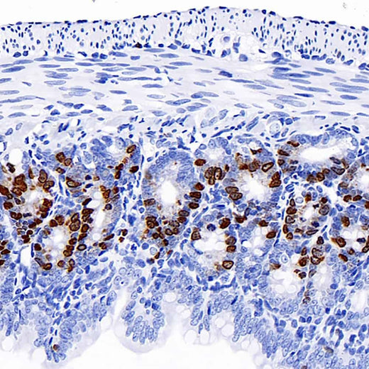 Immunohistochemistry analysis of paraffin-embedded mouse jejunum(intraperitoneal injection BrdU every 2 hours for 4 times) using Brdu Monoclonal Antibody at dilution of 1:300.