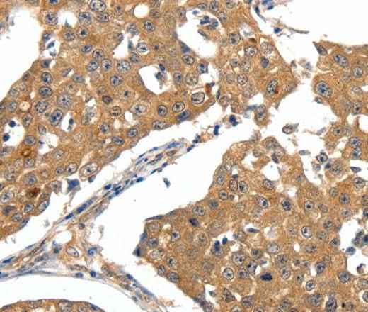 Anti-Human/Mouse/Rat SCN5A Antibody