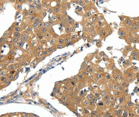 Anti-Human/Mouse/Rat SCN5A Antibody