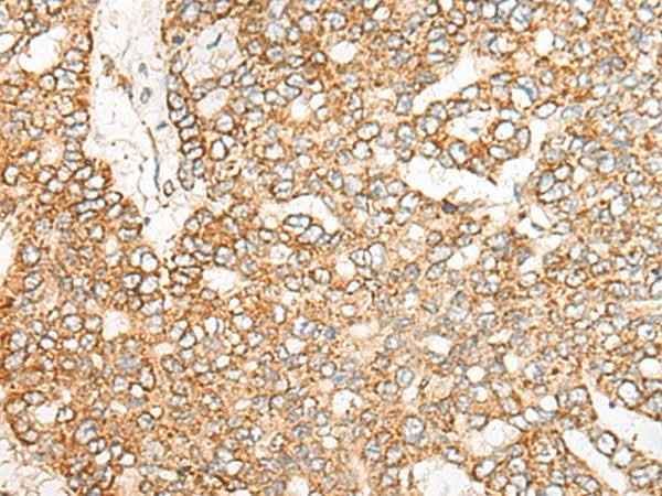 Anti-Human/Mouse NME4 Antibody
