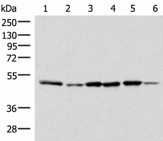 Western blot analysis of Jurkat PC-3 HepG2 Hela HT-29 and Raji cell lysates using IP6K1 Polyclonal Antibody at dilution of 1:400