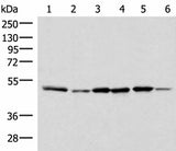 Western blot analysis of Jurkat PC-3 HepG2 Hela HT-29 and Raji cell lysates using IP6K1 Polyclonal Antibody at dilution of 1:400