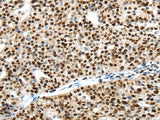 Anti-Human/Mouse/Rat UBA1 Antibody - ABMIUM