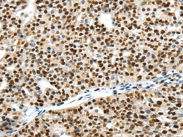 Anti-Human/Mouse/Rat UBA1 Antibody - ABMIUM