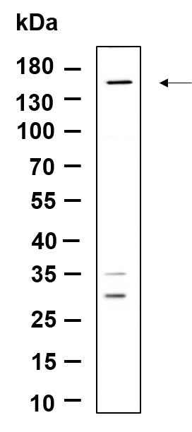 Anti-Human/Mouse/Rat Drosha Antibody [B921] - ABMIUM
