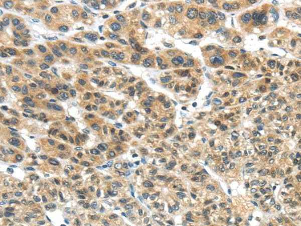 Anti-Human TKTL1 Antibody