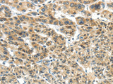 Anti-Human TKTL1 Antibody - ABMIUM