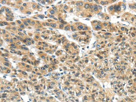 Anti-Human TKTL1 Antibody - ABMIUM