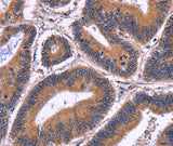 Anti-Human SPATA7 Antibody - ABMIUM