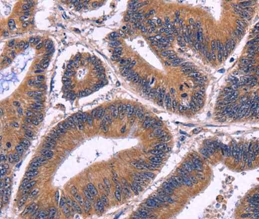 Anti-Human SPATA7 Antibody