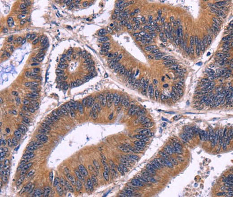Anti-Human SPATA7 Antibody - ABMIUM
