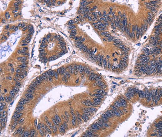 Anti-Human SPATA7 Antibody - ABMIUM