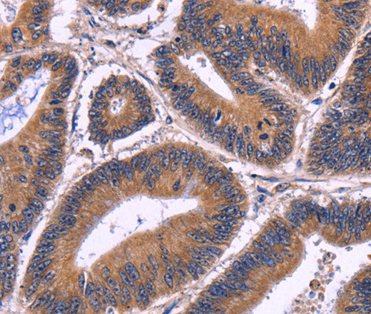 Anti-Human SPATA7 Antibody - ABMIUM