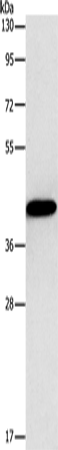 Anti-Human/Mouse/Rat GJC1 Antibody - ABMIUM