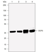 Anti-Human/Rat/Mouse SCP3 Antibody [A719] - ABMIUM