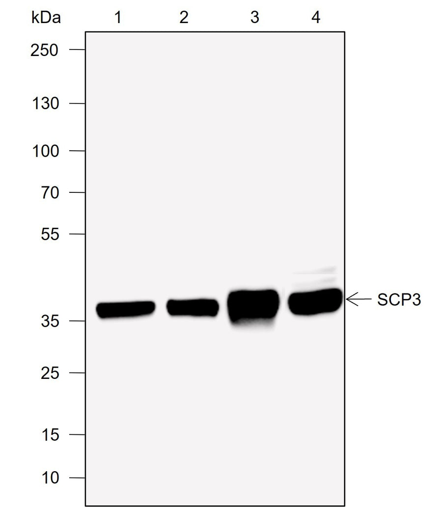 Anti-Human/Rat/Mouse SCP3 Antibody [A719] - ABMIUM